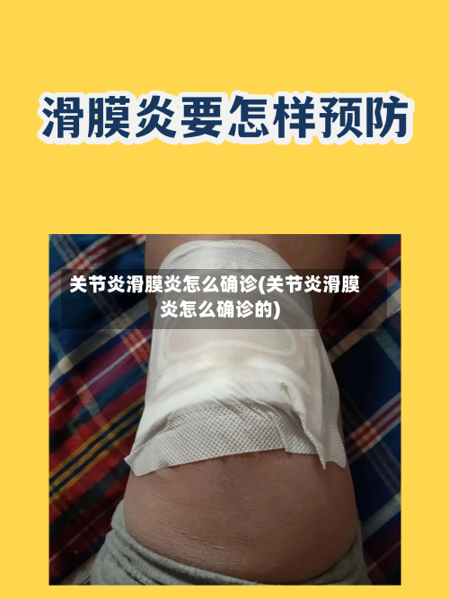 关节炎滑膜炎怎么确诊(关节炎滑膜炎怎么确诊的)-第1张图片
