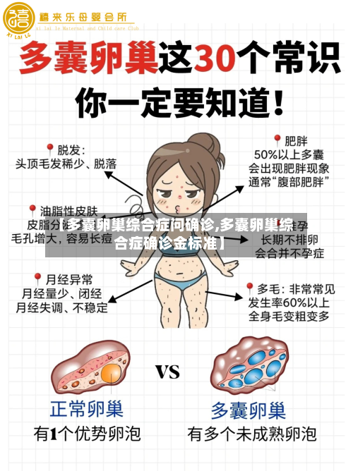【多囊卵巢综合症问确诊,多囊卵巢综合症确诊金标准】