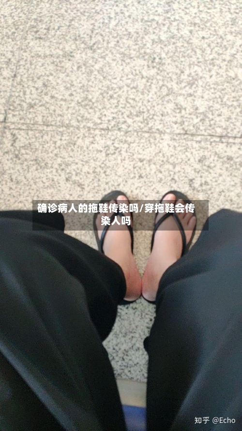 确诊病人的拖鞋传染吗/穿拖鞋会传染人吗-第2张图片