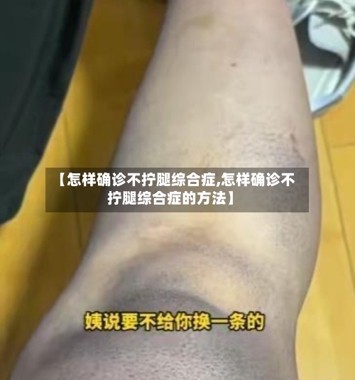 【怎样确诊不拧腿综合症,怎样确诊不拧腿综合症的方法】-第2张图片