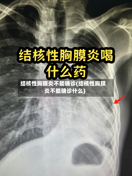 结核性胸膜炎不能确诊(结核性胸膜炎不能确诊什么)