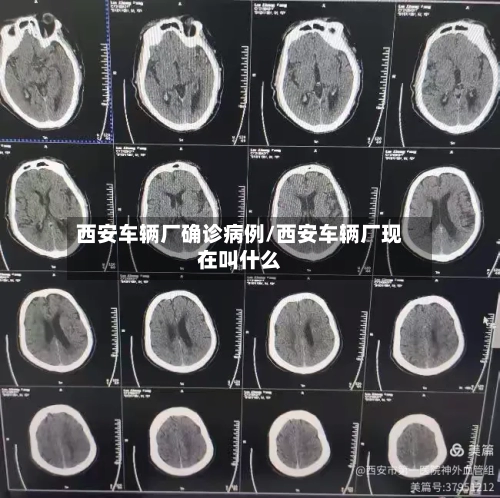 西安车辆厂确诊病例/西安车辆厂现在叫什么-第3张图片