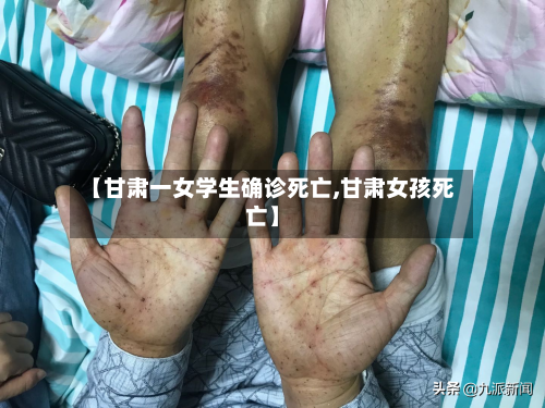 【甘肃一女学生确诊死亡,甘肃女孩死亡】-第3张图片