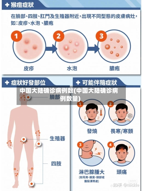 中国大陆确诊病例数(中国大陆确诊病例数量)