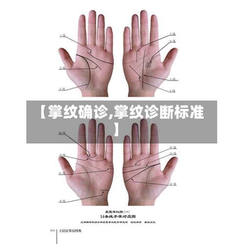 【掌纹确诊,掌纹诊断标准】-第2张图片