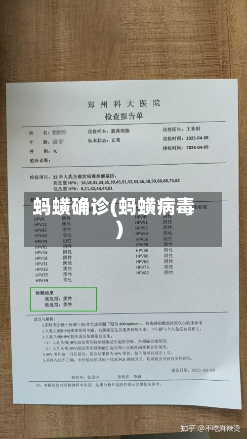 蚂蟥确诊(蚂蟥病毒)-第3张图片