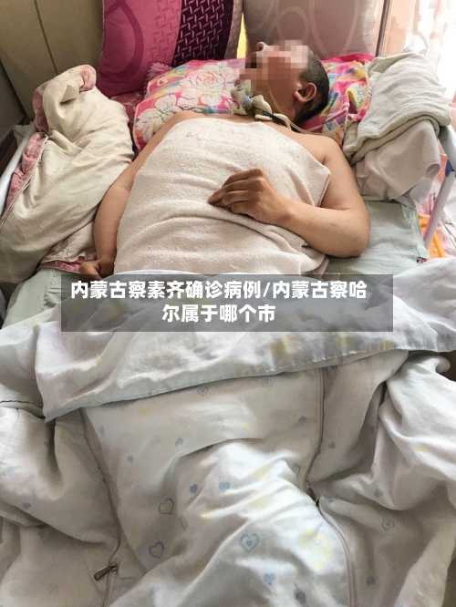 内蒙古察素齐确诊病例/内蒙古察哈尔属于哪个市-第3张图片