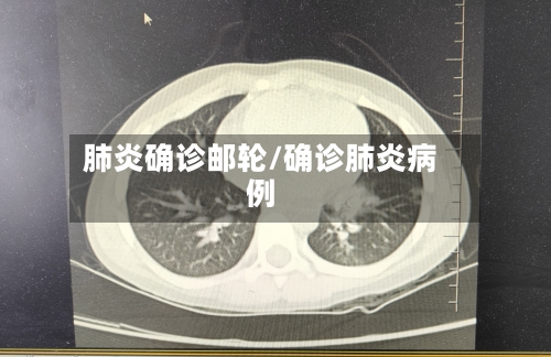 肺炎确诊邮轮/确诊肺炎病例