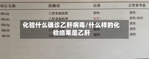 化验什么确诊乙肝病毒/什么样的化验结果是乙肝-第3张图片