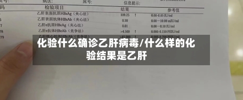 化验什么确诊乙肝病毒/什么样的化验结果是乙肝-第2张图片