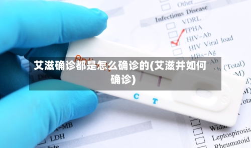 艾滋确诊都是怎么确诊的(艾滋并如何确诊)-第2张图片