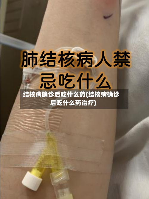 结核病确诊后吃什么药(结核病确诊后吃什么药治疗)