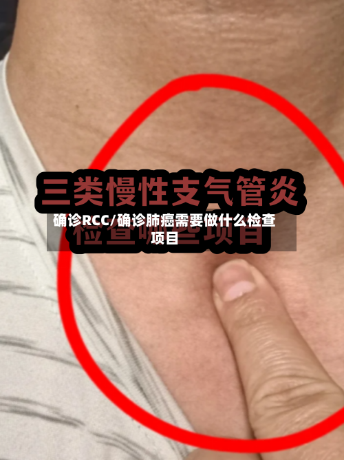 确诊RCC/确诊肺癌需要做什么检查项目