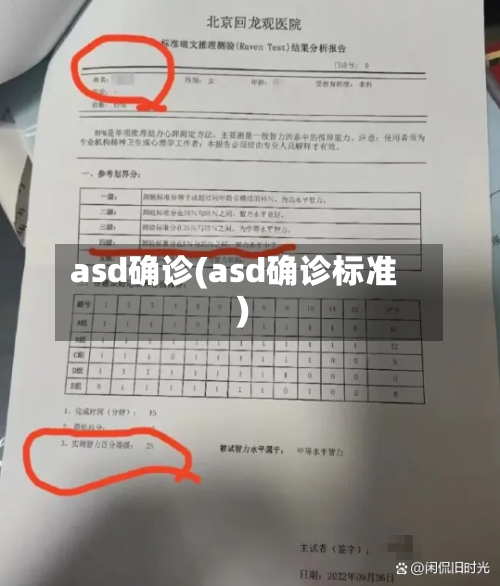 asd确诊(asd确诊标准)