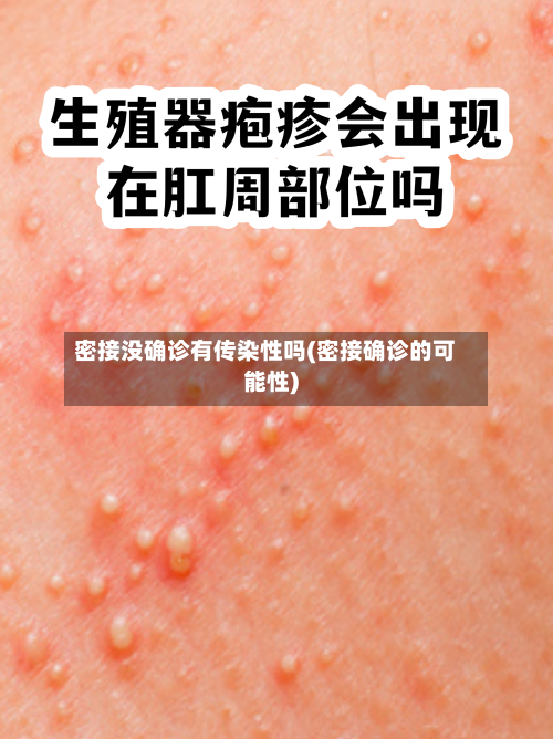 密接没确诊有传染性吗(密接确诊的可能性)-第2张图片
