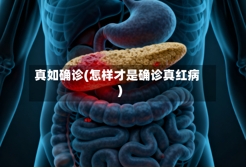真如确诊(怎样才是确诊真红病)-第2张图片