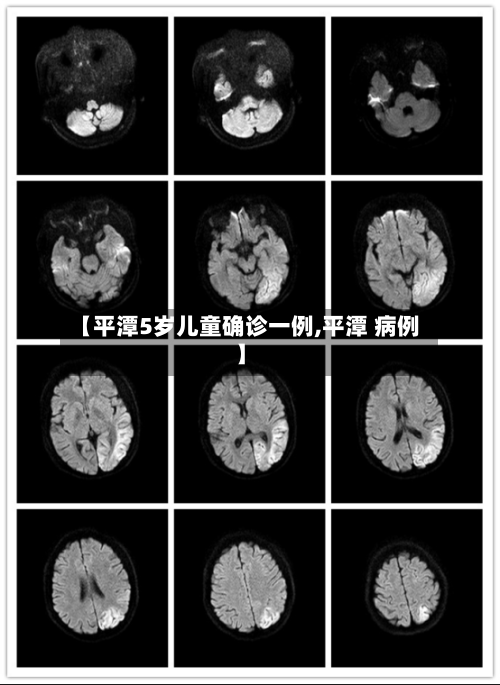 【平潭5岁儿童确诊一例,平潭 病例】